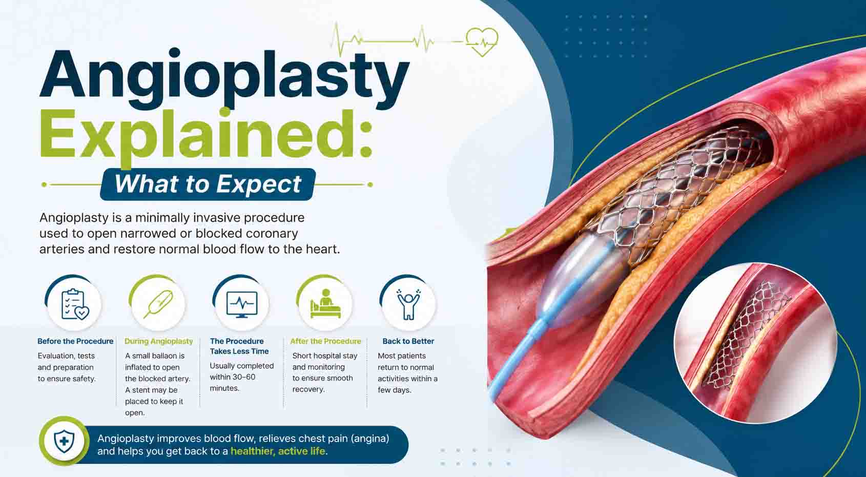 angioplasty-explained-what-to-expect